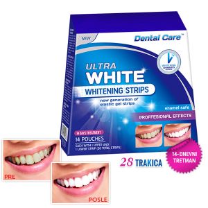 ULTRA WHITE trake za izbeljivanje zuba (28 trakica)